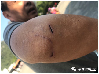 一位青岛旅客和家人国庆在阳朔的旅游噩梦，识破诈骗竟被围殴！40 / 作者:给点阳光就灿烂 / 帖子ID:266226
