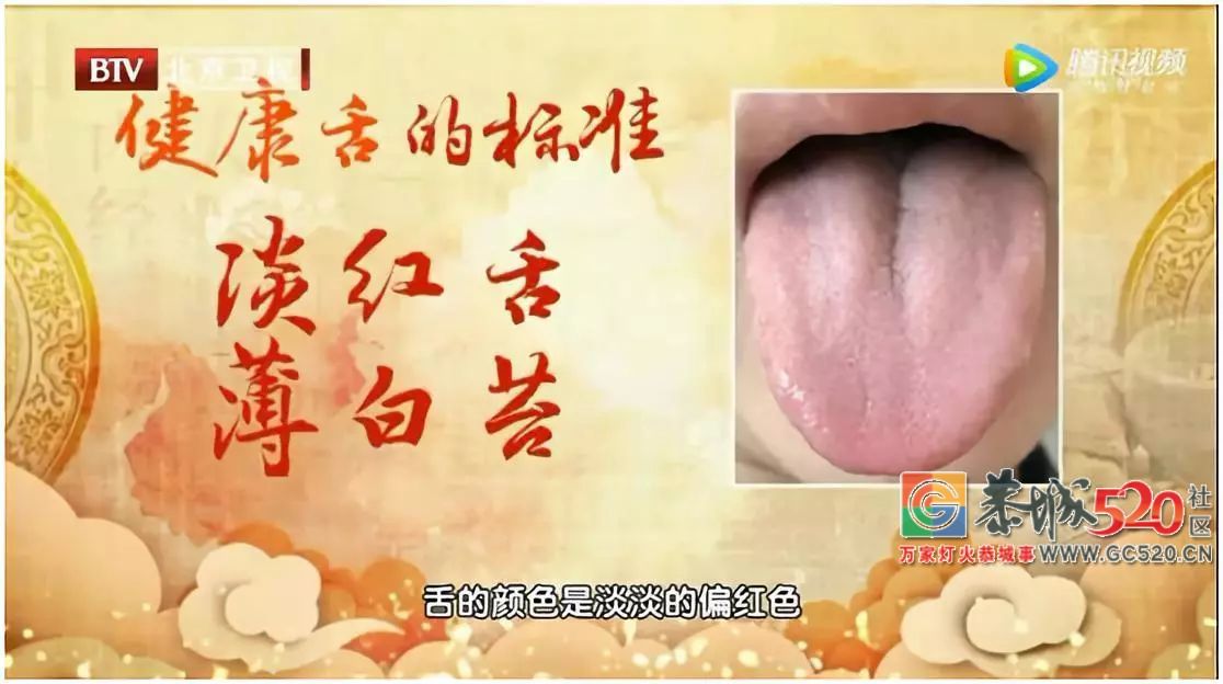 身体好不好，看舌头就知道！有这些舌象要注意调理187 / 作者:高负帅 / 帖子ID:266264