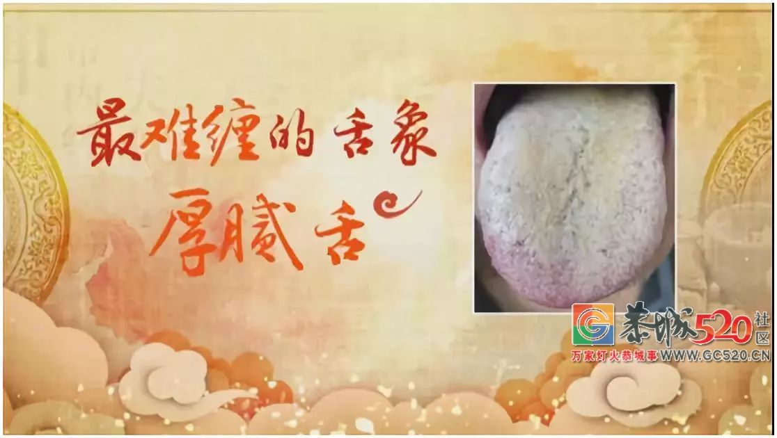 身体好不好，看舌头就知道！有这些舌象要注意调理827 / 作者:高负帅 / 帖子ID:266264