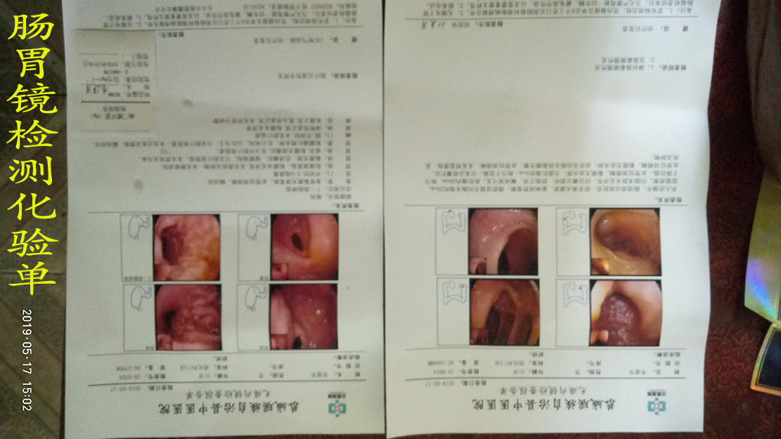 MDG身体检查体检看病笔记1696 / 作者:MDG / 帖子ID:267909