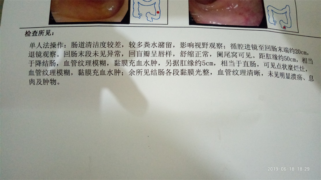 MDG身体检查体检看病笔记2327 / 作者:MDG / 帖子ID:268005