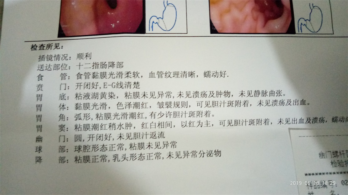 MDG身体检查体检看病笔记2448 / 作者:MDG / 帖子ID:268005