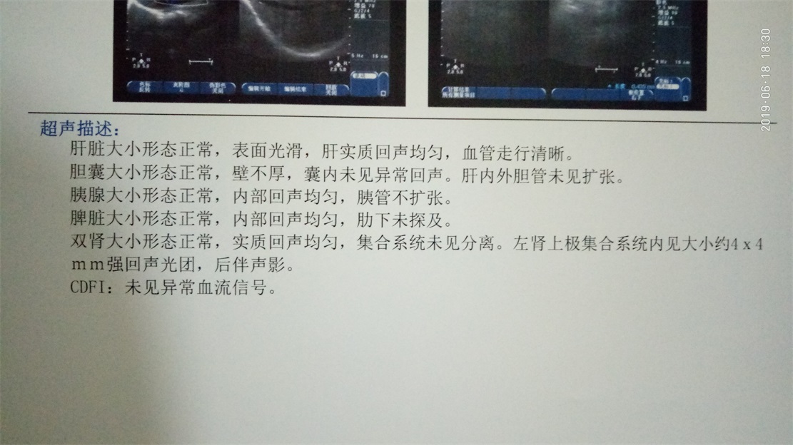 MDG身体检查体检看病笔记2284 / 作者:MDG / 帖子ID:268005