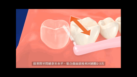刷牙、漱口、用牙线……到底如何保护牙齿？协和医生权威解答579 / 作者:给点阳光就灿烂 / 帖子ID:269151