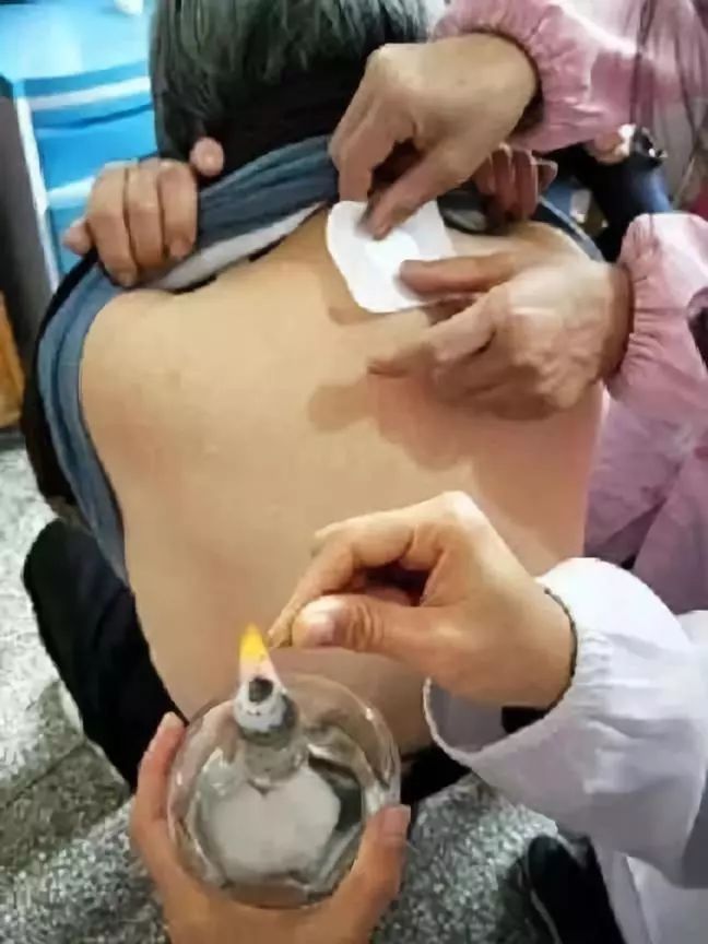 【健康恭城之窗】冬至将至，恭城县中医医院今年冬病冬治技术上新啦369 / 作者:东门头人 / 帖子ID:269810