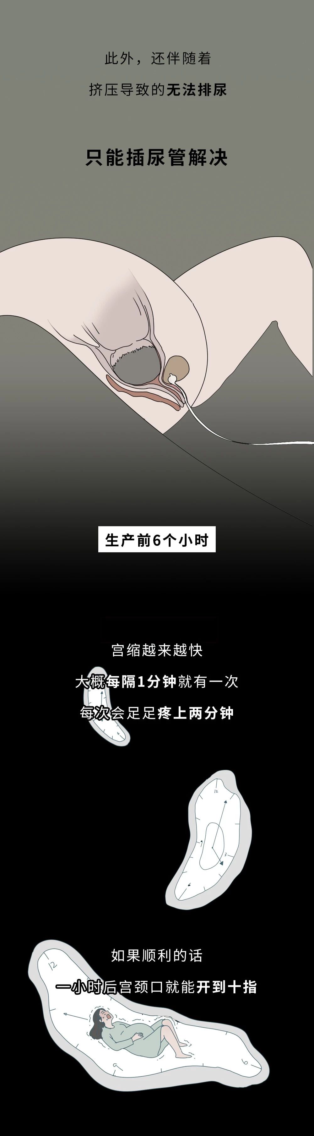 【荐读】一图告诉你生孩子“开十指”是咋回事，没人能笑着看完596 / 作者:该做的事情 / 帖子ID:270177