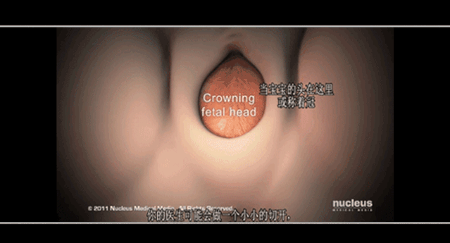 【荐读】一图告诉你生孩子“开十指”是咋回事，没人能笑着看完973 / 作者:该做的事情 / 帖子ID:270177