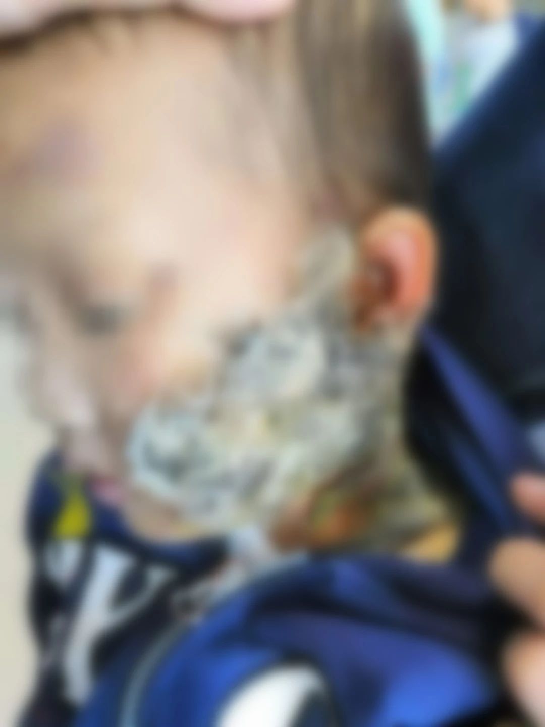 孩子烫伤后，因家长这个愚蠢做法进了ICU！再忙也要看！633 / 作者:雨云儿 / 帖子ID:273085