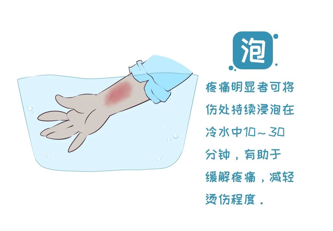 孩子烫伤后，因家长这个愚蠢做法进了ICU！再忙也要看！26 / 作者:雨云儿 / 帖子ID:273085