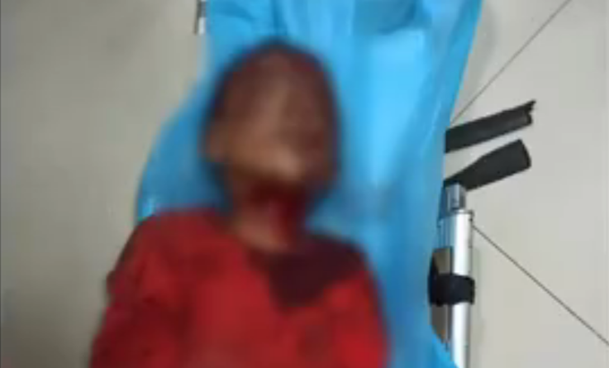 成都殴打8岁男童17岁嫌疑人已被刑拘，地下室暴打两小时455 / 作者:Killua / 帖子ID:273343