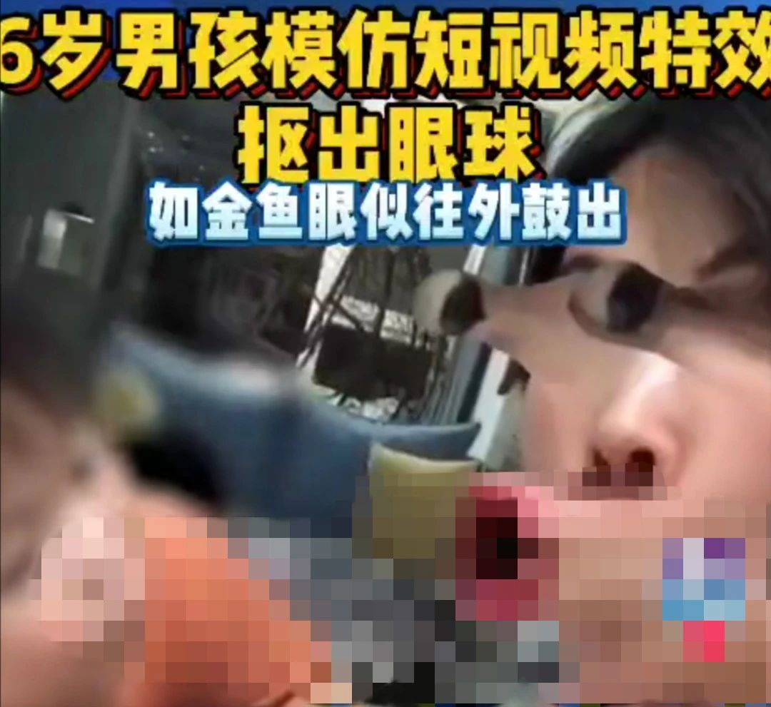 太可怕！模仿视频特效，浙江6岁男孩把自己眼球抠坏了204 / 作者:華大夫 / 帖子ID:273956