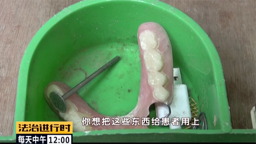 通州：女子找黑牙医补牙，结果悲剧了85 / 作者:麻辣鸡翅 / 帖子ID:274225