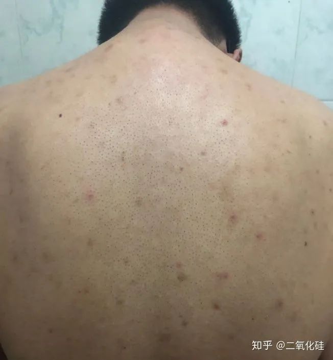 淘宝上低于这个价格的衣服千万不要买585 / 作者:分叉路口 / 帖子ID:274930