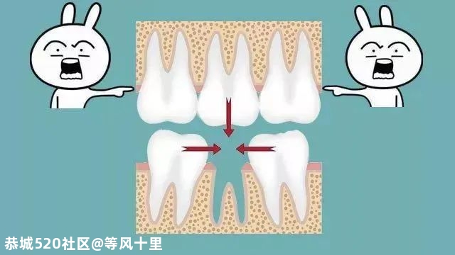 大部分中国人都有的口腔问题，越早治疗越省钱636 / 作者:等风十里 / 帖子ID:276013