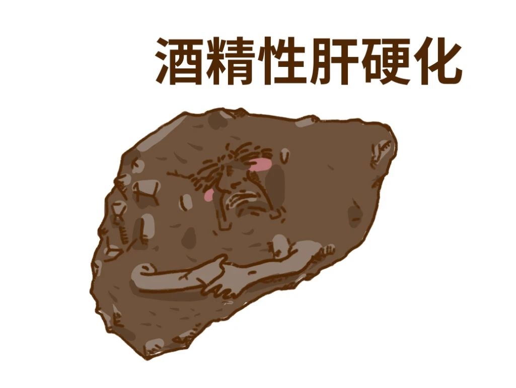 你的肝，是怎么一步步坏掉的863 / 作者:等风十里 / 帖子ID:276646
