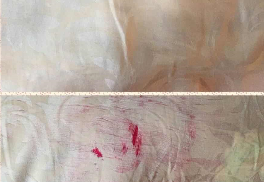 男人的屁股究竟是什么做的，能把每条内裤都穿出洞？354 / 作者:華大夫 / 帖子ID:276899
