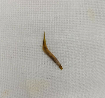 贵阳男子吃酒后回家腹痛，差点丟了命！罪魁祸首竟然是…每个人都要注意880 / 作者:華大夫 / 帖子ID:277789
