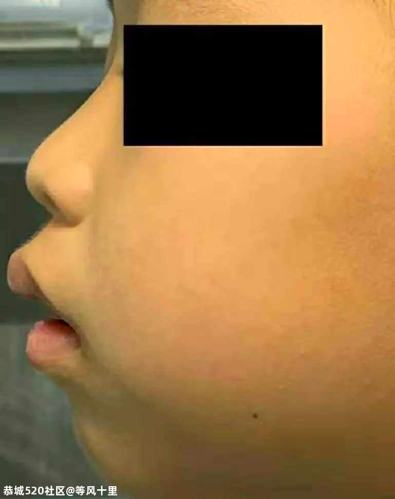警惕！孩子打喷嚏、流鼻涕不一定是感冒，后果可能更严重924 / 作者:等风十里 / 帖子ID:278600
