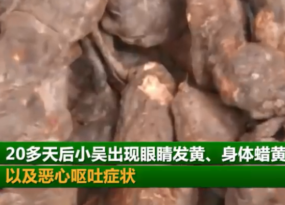 悲剧了！90后小伙用TA治白发，结果全身“变黄”，还…12 / 作者:宇宙无限 / 帖子ID:278904