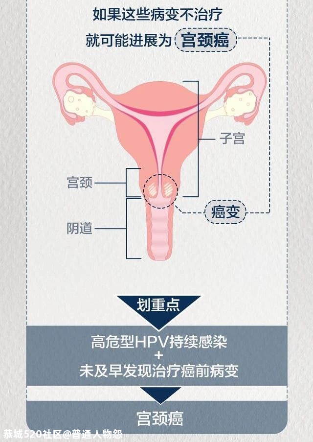 每年致超30万女性死亡！这种癌，即将被消除！656 / 作者:普通人物怨 / 帖子ID:279523