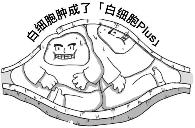 为什么说每个人的血管都可能会堵？401 / 作者:健康小天使 / 帖子ID:279623