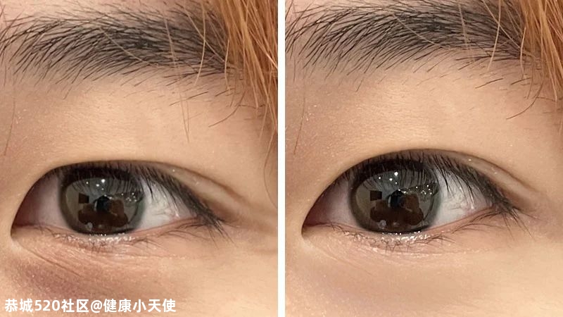 眼睛会放电，到底是玄学还是科学？325 / 作者:健康小天使 / 帖子ID:280013