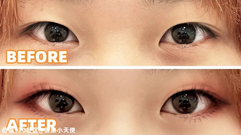 眼睛会放电，到底是玄学还是科学？603 / 作者:健康小天使 / 帖子ID:280013