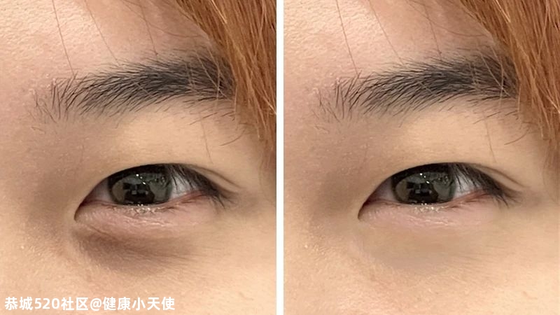 眼睛会放电，到底是玄学还是科学？144 / 作者:健康小天使 / 帖子ID:280013