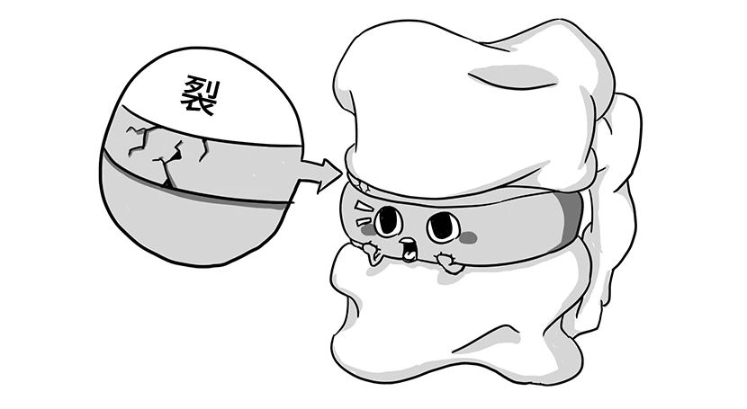 腰椎间盘突出，其实就像婆媳矛盾74 / 作者:健康小天使 / 帖子ID:280161