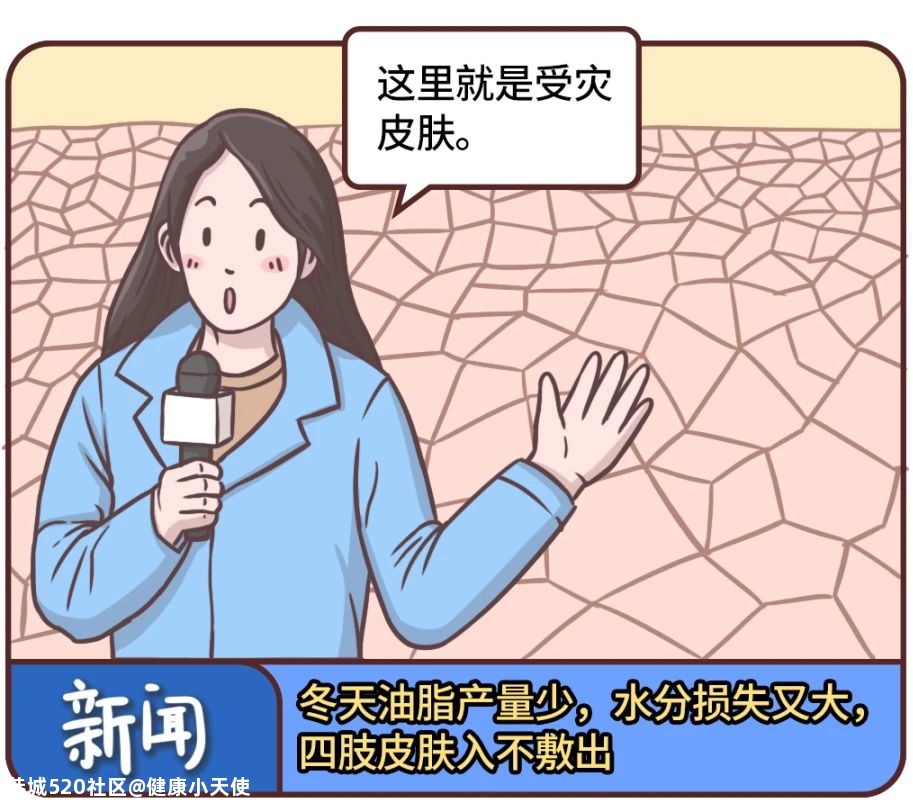 身上起皮刺痒，靠洗澡解决不了问题！真正管用的是……136 / 作者:健康小天使 / 帖子ID:280300