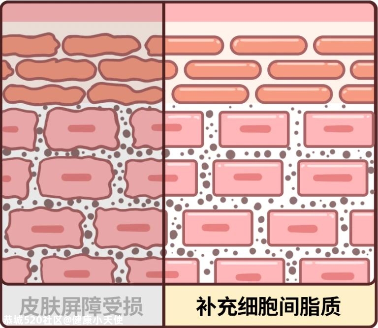 身上起皮刺痒，靠洗澡解决不了问题！真正管用的是……242 / 作者:健康小天使 / 帖子ID:280300