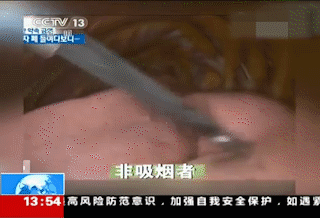 3 包烟就能熏黑一个肺！看过这组实验，你一定能戒烟469 / 作者:健康小天使 / 帖子ID:281144