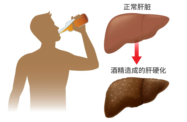 遇到 5 种人，千万别劝酒！207 / 作者:健康小天使 / 帖子ID:281234