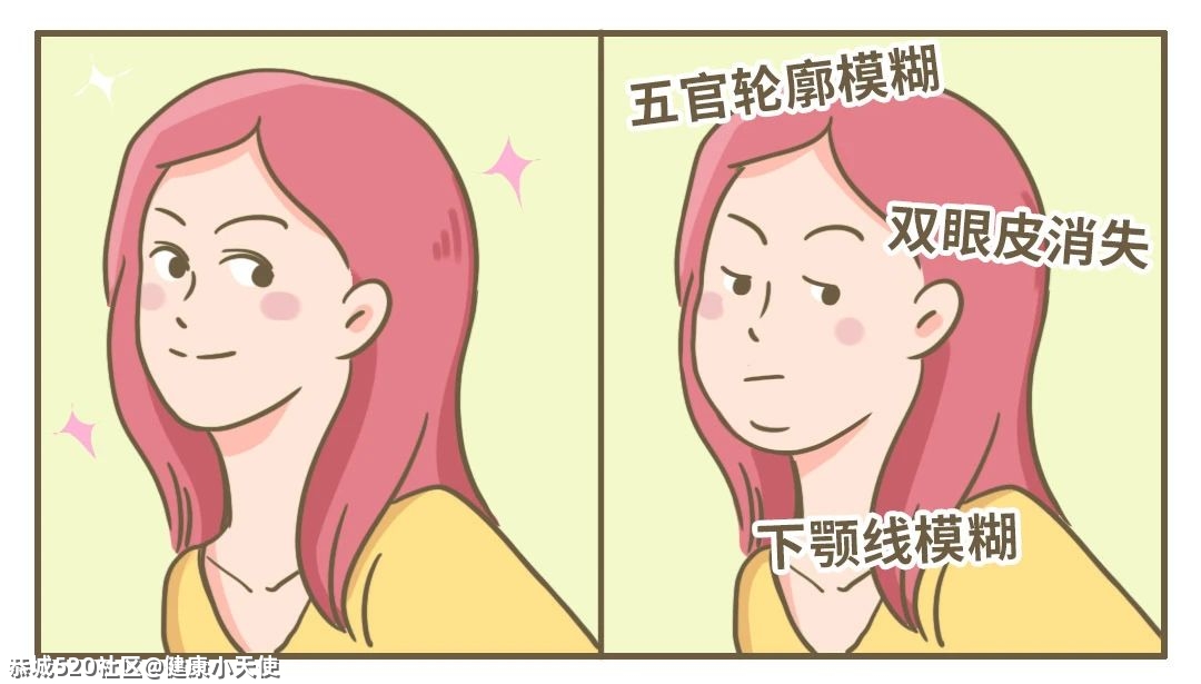 为什么女生早上起床容易肿？原来这才是真相……832 / 作者:健康小天使 / 帖子ID:282637
