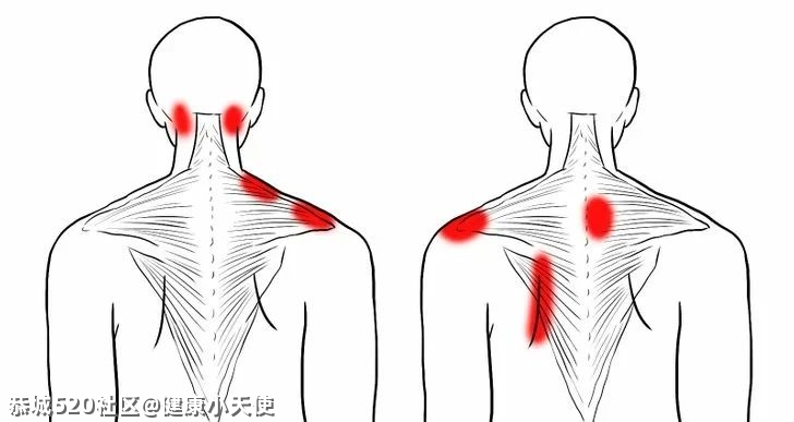 “拉筋”拉的到底是什么？不同人群各有「最佳拉伸法」671 / 作者:健康小天使 / 帖子ID:282735