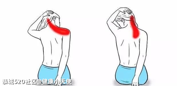 “拉筋”拉的到底是什么？不同人群各有「最佳拉伸法」967 / 作者:健康小天使 / 帖子ID:282735