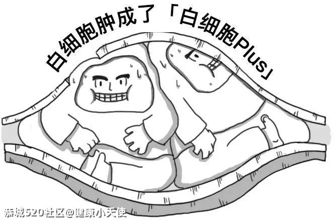 你的血管，就是这样堵的！107 / 作者:健康小天使 / 帖子ID:284196