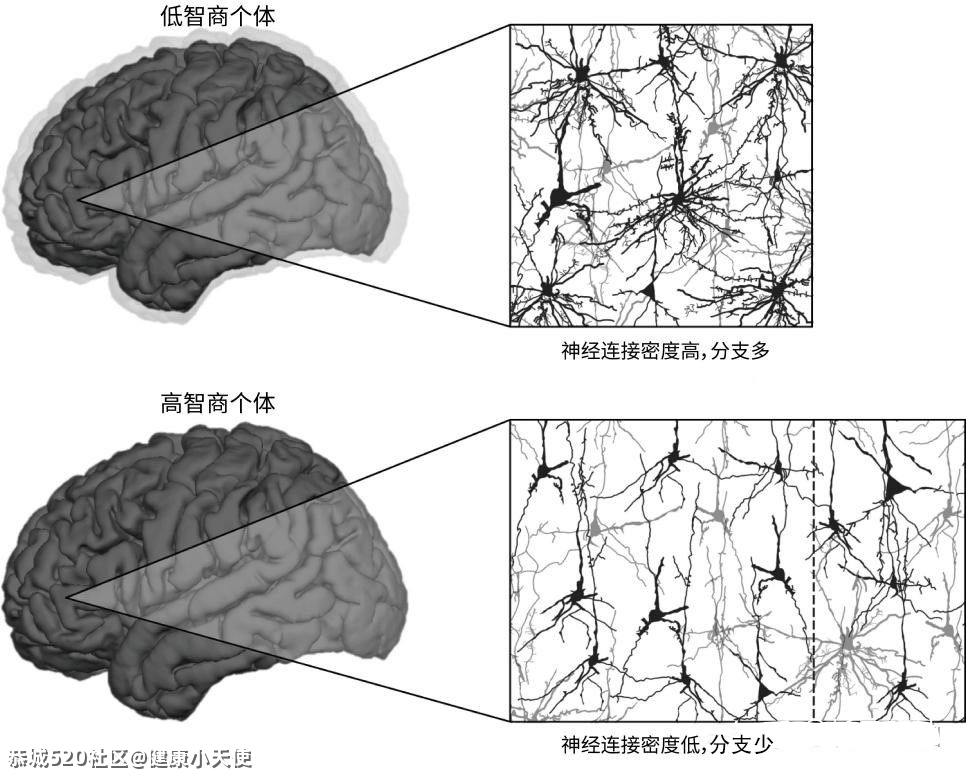 聪明的人，大脑结构会不一样吗？31 / 作者:健康小天使 / 帖子ID:284601