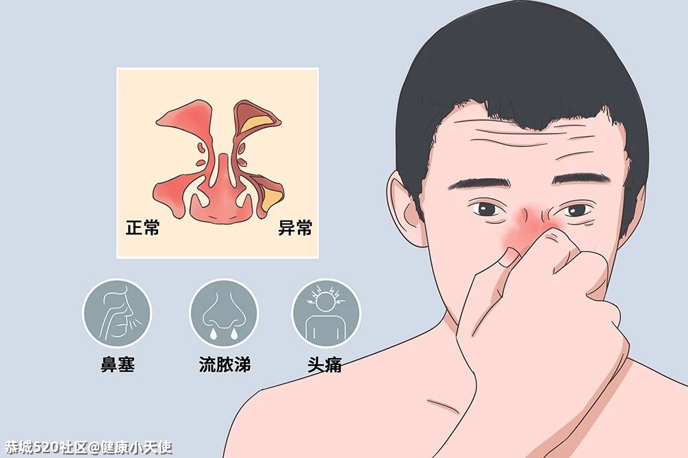 为什么打呼噜的男人比女人多？从生理结构上他们就输了255 / 作者:健康小天使 / 帖子ID:285120