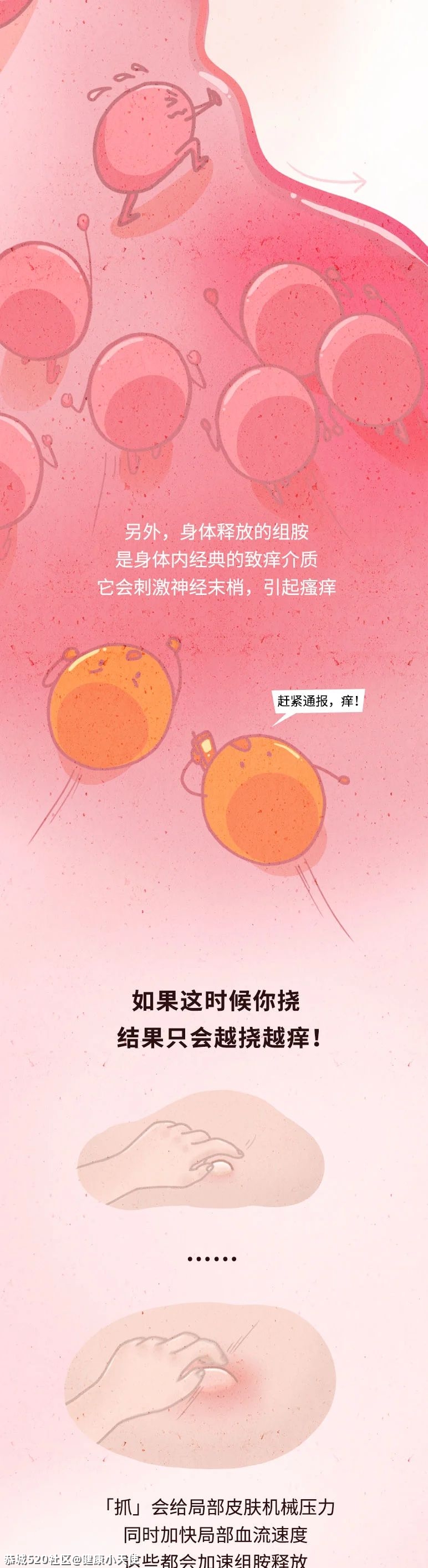 千万别挠蚊子包！不然……109 / 作者:健康小天使 / 帖子ID:286376