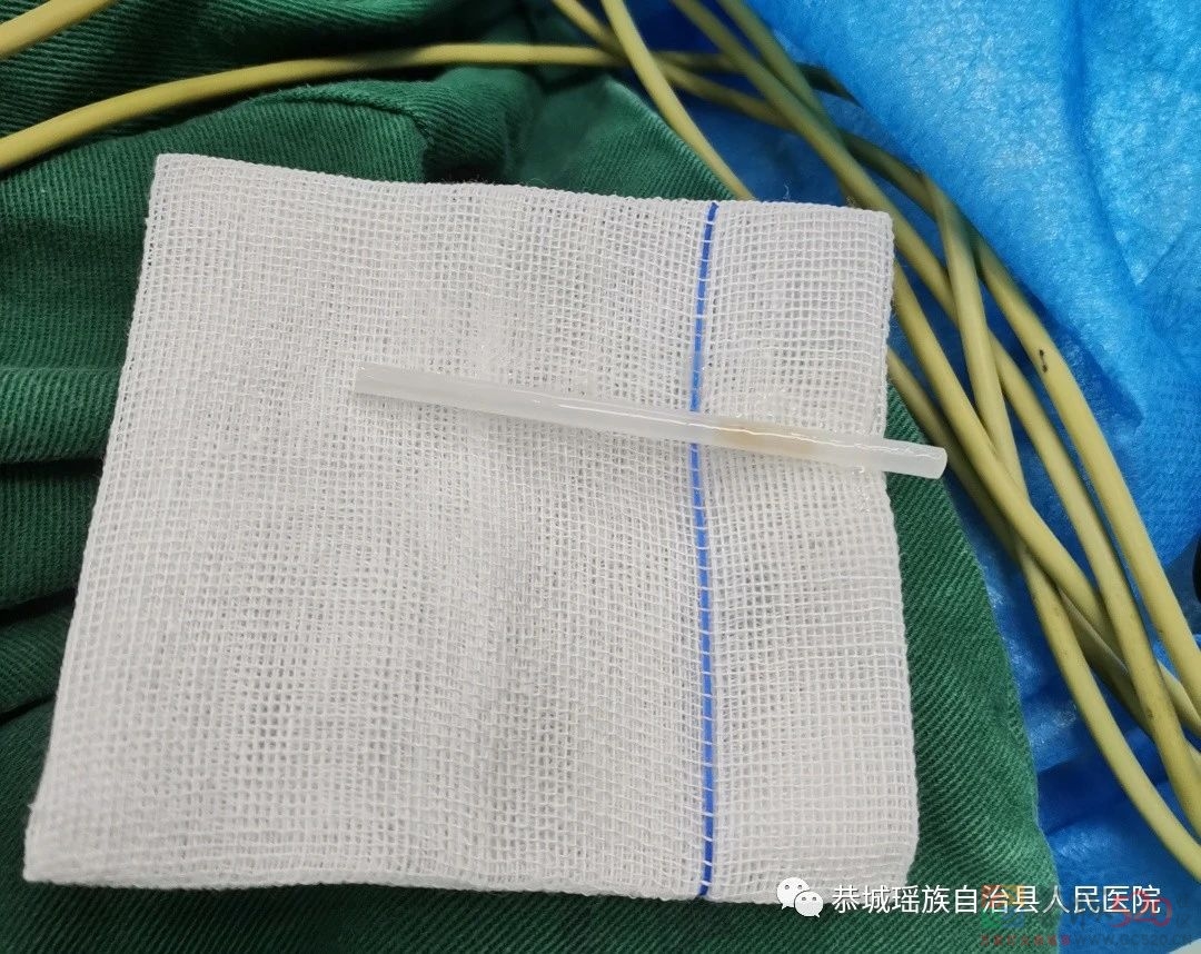 家长们注意了！恭城又一名9岁小把爷吞下棒棒糖塑料棍！还好......717 / 作者:论坛小编01 / 帖子ID:287140