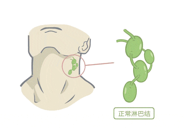 有一种癌偏爱「南方人」，这个省的发病数占了全国的60%970 / 作者:健康小天使 / 帖子ID:287549