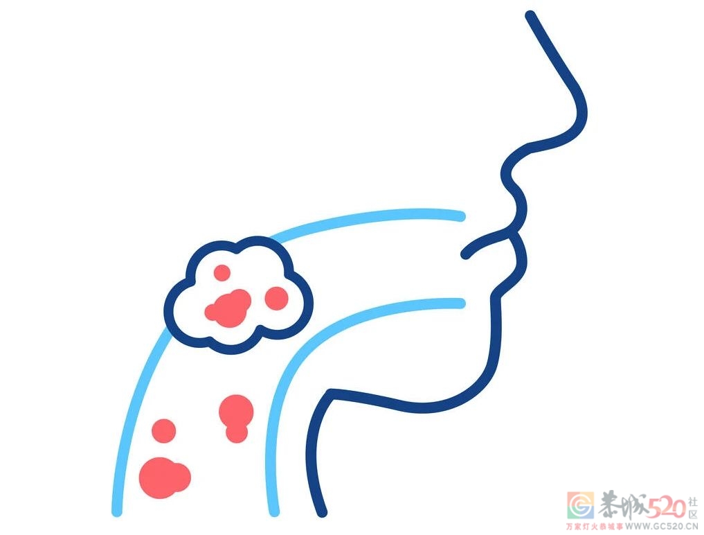 有一种癌偏爱「南方人」，这个省的发病数占了全国的60%525 / 作者:健康小天使 / 帖子ID:287549