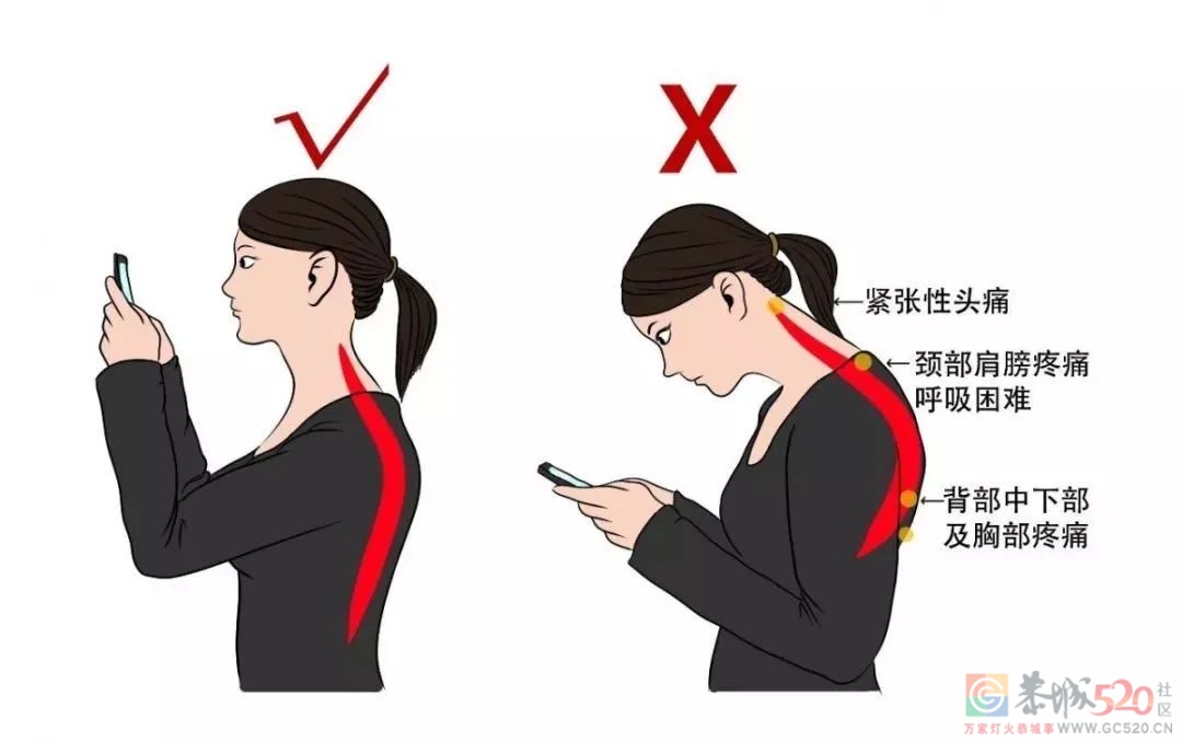 脖子后面的“富贵包”，究竟是怎么长出来的？227 / 作者:健康小天使 / 帖子ID:289694