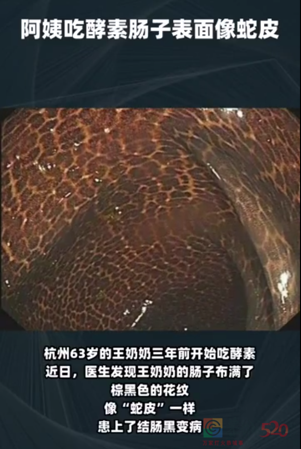 人体什么情况下需要“排毒”？医生的答案只有一个标准……660 / 作者:健康小天使 / 帖子ID:289751