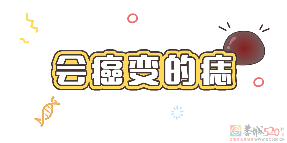 痣也可能会癌变！长在 3 个地方要注意133 / 作者:健康小天使 / 帖子ID:292802