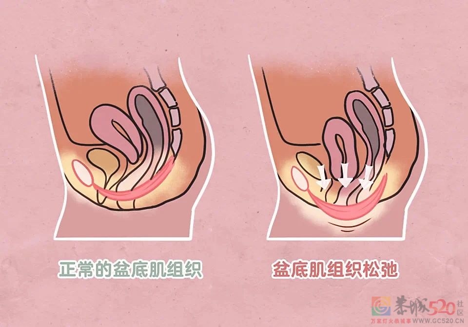 男人提肛练得好，性福不会少……吗？452 / 作者:健康小天使 / 帖子ID:293445