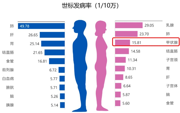 甲状腺癌发病率飙升20倍，问题到底出在哪里？604 / 作者:健康小天使 / 帖子ID:294822