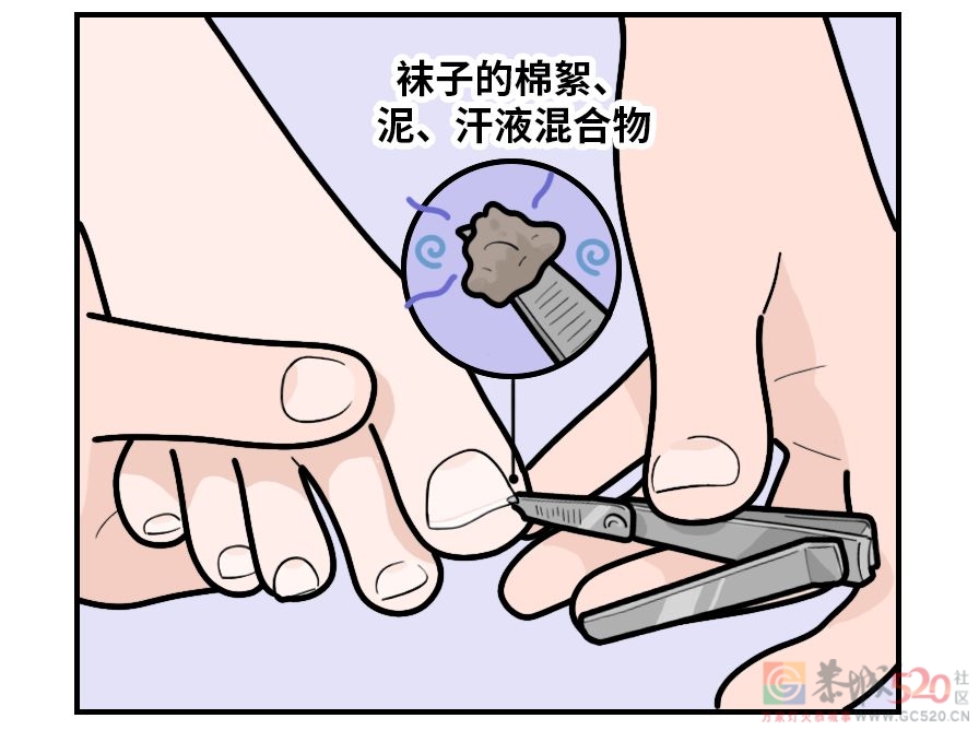 剪指甲的一个错误习惯，让很多人痛苦不堪527 / 作者:健康小天使 / 帖子ID:295200
