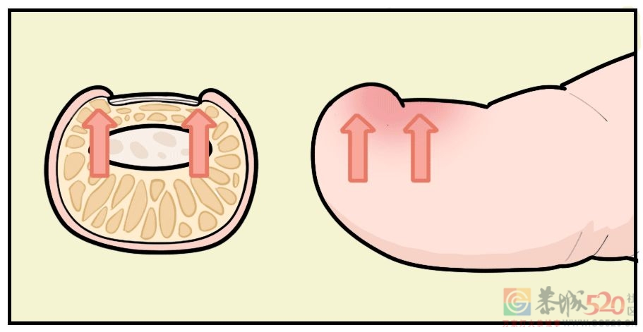 剪指甲的一个错误习惯，让很多人痛苦不堪672 / 作者:健康小天使 / 帖子ID:295200